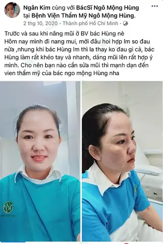 Nâng Mũi Có Thay Đổi Tướng Số Không: Góc Nhìn Nhân Tướng Học Và Khoa Học Nâng Mũi Có Thay Đổi Tướng Số Không: Góc Nhìn Nhân Tướng Học Và Khoa Học