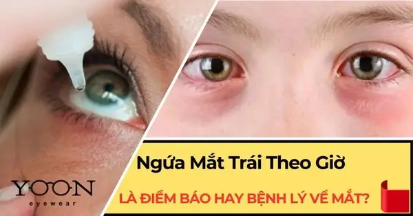 Giải Mã Ngứa Mắt Là Điềm Báo Gì Và Dấu Hiệu Bệnh Lý Cần Biết Giải Mã Ngứa Mắt Là Điềm Báo Gì Và Dấu Hiệu Bệnh Lý Cần Biết