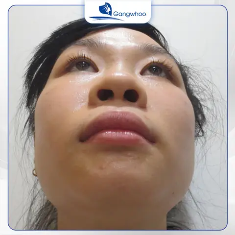 Giải Mã Tướng Mũi To: Tốt Hay Xấu Và Ý Nghĩa Nhân Tướng Học Cho Nam Nữ Giải Mã Tướng Mũi To: Tốt Hay Xấu Và Ý Nghĩa Nhân Tướng Học Cho Nam Nữ