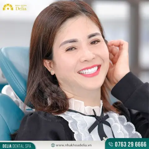 Giải Mã Tướng Răng Thỏ: Ý Nghĩa Nhân Tướng, Vận Mệnh & Giải Pháp Thẩm Mỹ Chuẩn Y Khoa