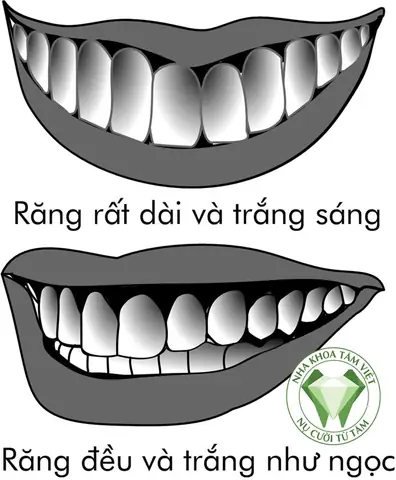 Giải Đáp Thực Hư: Nhổ Răng Có Ảnh Hưởng Đến Tướng Số Hay Chỉ Là Quan Niệm Dân Gian? Giải Đáp Thực Hư: Nhổ Răng Có Ảnh Hưởng Đến Tướng Số Hay Chỉ Là Quan Niệm Dân Gian?