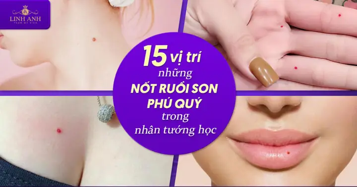 Tổng Hợp Những Vị Trí Nốt Ruồi Phú Quý Trên Mặt Và Cơ Thể Cho Nam Nữ