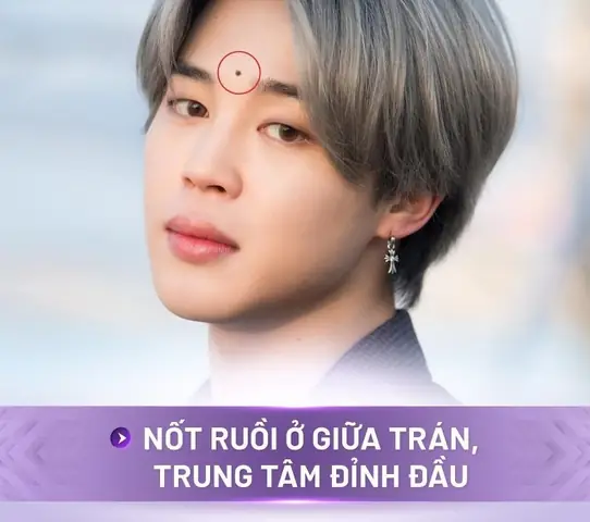 Những Vị Trí Nốt Ruồi Trên Mặt Nên Xóa Theo Nhân Tướng Học Và Y Khoa