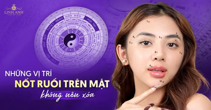 Những Vị Trí Nốt Ruồi Trên Mặt Nên Xóa Theo Nhân Tướng Học Và Y Khoa