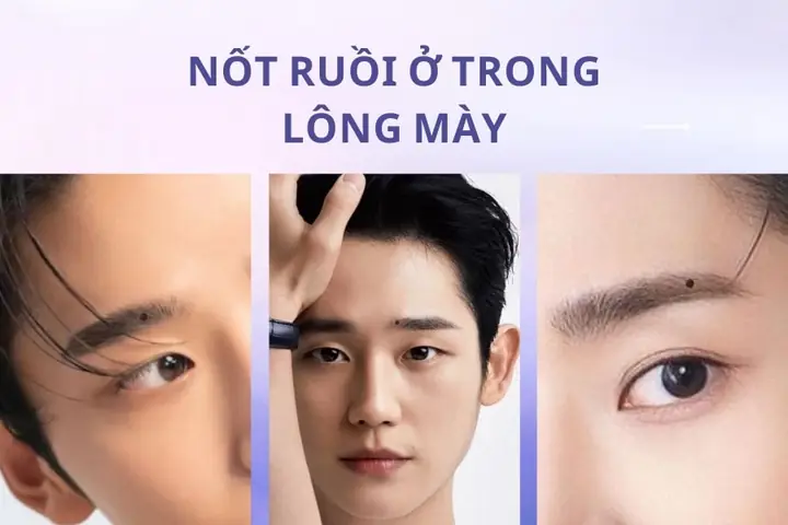 Những Vị Trí Nốt Ruồi Trên Mặt Nên Xóa Theo Nhân Tướng Học Và Y Khoa