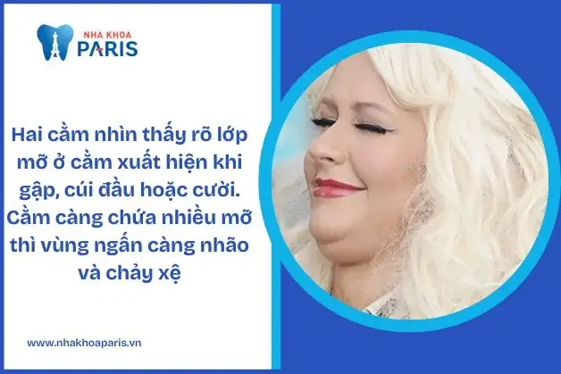 Giải Mã Tướng Số Nọng Cằm (hai Cằm): Ý Nghĩa Nam - Nữ, Tốt - Xấu Và Diễn Biến Vận Mệnh