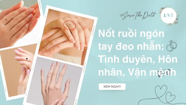 Giải Mã Ý Nghĩa Nốt Ruồi Trên Ngón Đeo Nhẫn: Tốt Hay Xấu, Tình Duyên Và Vận Mệnh Giải Mã Ý Nghĩa Nốt Ruồi Trên Ngón Đeo Nhẫn: Tốt Hay Xấu, Tình Duyên Và Vận Mệnh