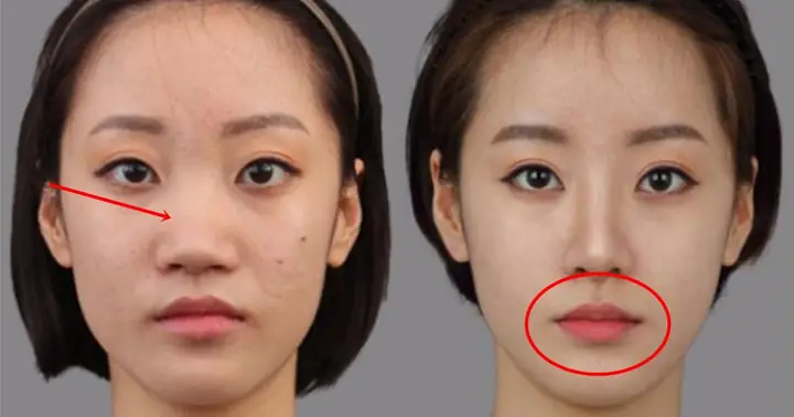 Phẫu Thuật Thẩm Mỹ Mặt Có Thay Đổi Tướng Số Hay Không Và Góc Nhìn Từ Nhân Tướng Học Phẫu Thuật Thẩm Mỹ Mặt Có Thay Đổi Tướng Số Hay Không Và Góc Nhìn Từ Nhân Tướng Học