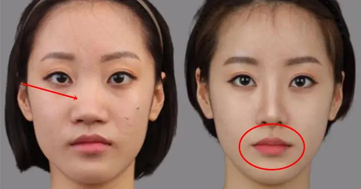 Phẫu Thuật Thay Đổi Tướng Số Có Thật Sự Ảnh Hưởng Đến Vận Mệnh Hay Không? Phẫu Thuật Thay Đổi Tướng Số Có Thật Sự Ảnh Hưởng Đến Vận Mệnh Hay Không?