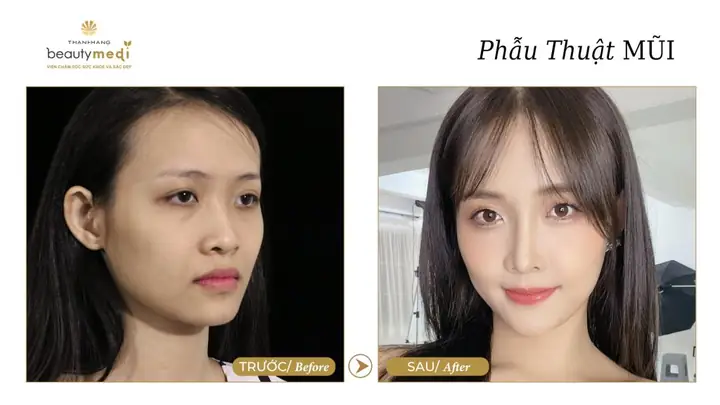 Giải Nghĩa Tướng Mũi Diều Hâu Ở Phụ Nữ: Ý Nghĩa Nhân Tướng Học Và Đặc Điểm Tính Cách Giải Nghĩa Tướng Mũi Diều Hâu Ở Phụ Nữ: Ý Nghĩa Nhân Tướng Học Và Đặc Điểm Tính Cách