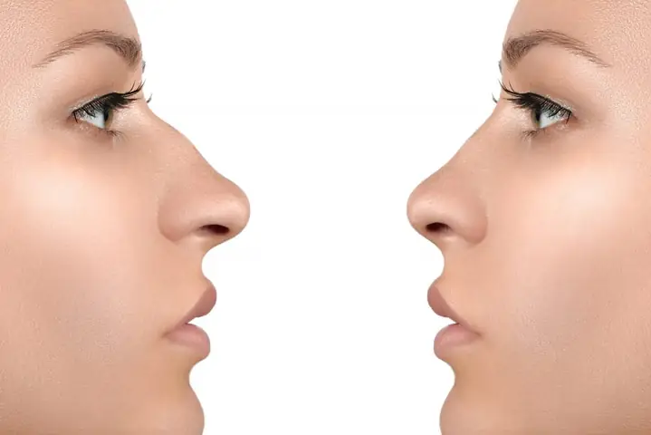 Giải Nghĩa Tướng Mũi Diều Hâu Ở Phụ Nữ: Ý Nghĩa Nhân Tướng Học Và Đặc Điểm Tính Cách Giải Nghĩa Tướng Mũi Diều Hâu Ở Phụ Nữ: Ý Nghĩa Nhân Tướng Học Và Đặc Điểm Tính Cách