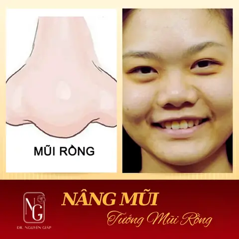 Giải Mã Tướng Mũi Rồng Ở Phụ Nữ: Vận Mệnh, Tính Cách Và Đặc Điểm Dáng Mũi Giải Mã Tướng Mũi Rồng Ở Phụ Nữ: Vận Mệnh, Tính Cách Và Đặc Điểm Dáng Mũi