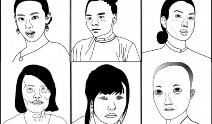 Lưỡng Quyền (quyền) Trong Tướng Số Là Gì? 9 Hình Thái, Ý Nghĩa Và Cách Xem Vận Mệnh Chi Tiết
