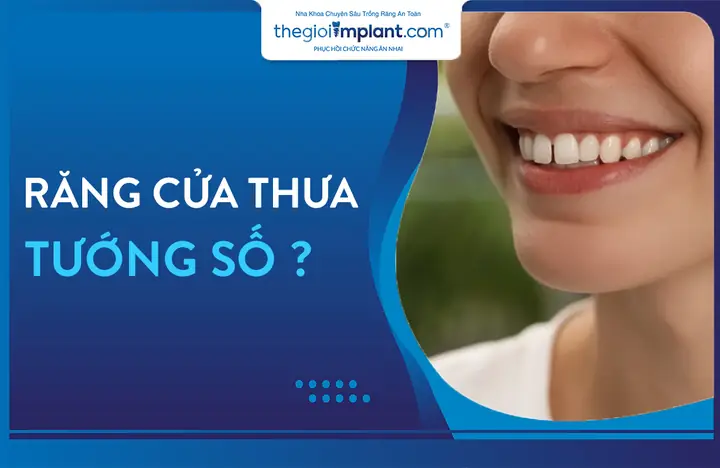 Giải Mã Tướng Số Răng Cửa Thưa: Ý Nghĩa Vận Mệnh, Tốt Xấu Và Cách Khắc Phục Hiệu Quả Giải Mã Tướng Số Răng Cửa Thưa: Ý Nghĩa Vận Mệnh, Tốt Xấu Và Cách Khắc Phục Hiệu Quả
