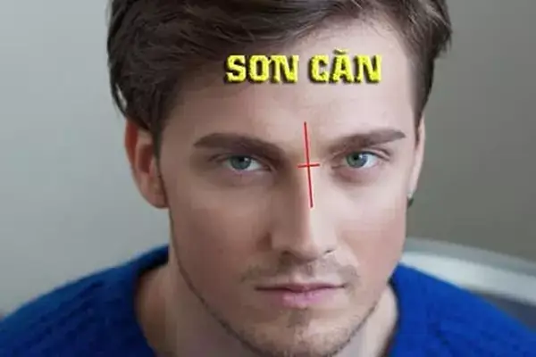 Giải Mã Ý Nghĩa Sẹo Ở Mũi Tướng Số: Vị Trí Tốt/xấu & Cách Khắc Phục Hiệu Quả
