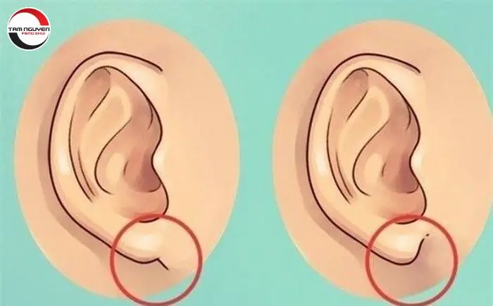 Tướng Tai Nhỏ: Giải Mã Ý Nghĩa, Dấu Hiệu Hung Cát Và Vận Mệnh Nam Nữ Chi Tiết Tướng Tai Nhỏ: Giải Mã Ý Nghĩa, Dấu Hiệu Hung Cát Và Vận Mệnh Nam Nữ Chi Tiết