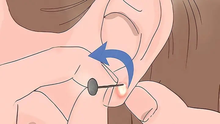 Tại Sao Đeo Bông Tai Bị Đau Và Cách Xử Lý Hiệu Quả Cho Người Mới Bị Kích Ứng Tại Sao Đeo Bông Tai Bị Đau Và Cách Xử Lý Hiệu Quả Cho Người Mới Bị Kích Ứng