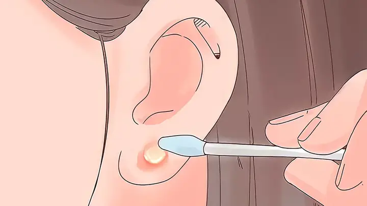 Tại Sao Đeo Bông Tai Bị Đau Và Cách Xử Lý Hiệu Quả Cho Người Mới Bị Kích Ứng Tại Sao Đeo Bông Tai Bị Đau Và Cách Xử Lý Hiệu Quả Cho Người Mới Bị Kích Ứng