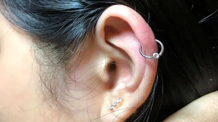 Tại Sao Đeo Bông Tai Bị Đau Và Cách Xử Lý Hiệu Quả Cho Người Mới Bị Kích Ứng Tại Sao Đeo Bông Tai Bị Đau Và Cách Xử Lý Hiệu Quả Cho Người Mới Bị Kích Ứng