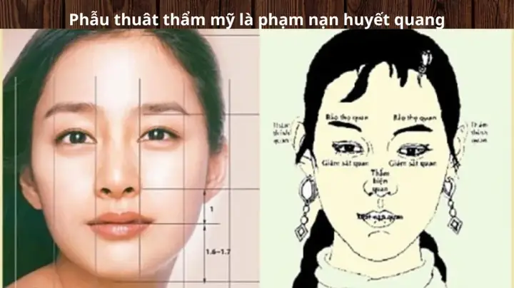 Lý Giải Vì Sao Sửa Tướng Mặt Lại Sửa Số Mệnh Theo Nhân Tướng Học