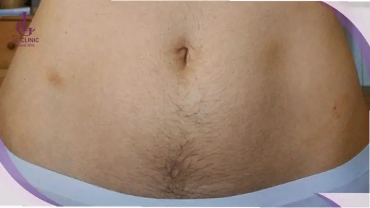 Xem Tướng Bụng Phụ Nữ: Giải Mã 14+ Đặc Điểm Tướng Giàu Sang, Phúc Lộc Theo Nhân Tướng Học Xem Tướng Bụng Phụ Nữ: Giải Mã 14+ Đặc Điểm Tướng Giàu Sang, Phúc Lộc Theo Nhân Tướng Học
