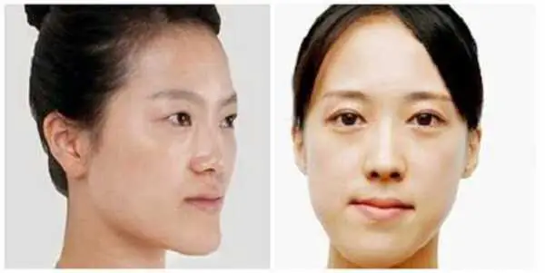 Xem Tướng Cằm Nhô Ra: Ý Nghĩa Tướng Số Nam Nữ & Cách Khắc Phục Hiệu Quả Xem Tướng Cằm Nhô Ra: Ý Nghĩa Tướng Số Nam Nữ & Cách Khắc Phục Hiệu Quả