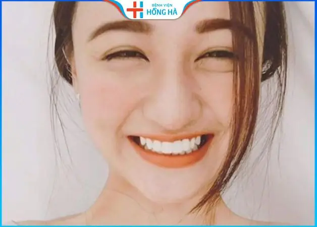 Giải Nghĩa Tướng Con Gái Có Bọng Mắt Cười Và Ý Nghĩa Phúc Tướng Của Phụ Nữ