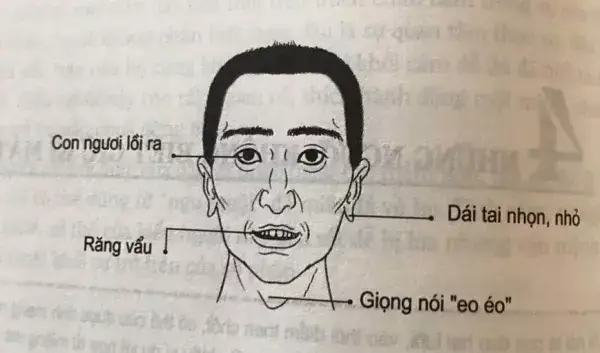 Nhận Diện Tướng Đàn Ông Mặt Thỏ Mỏ Dơi Và Ý Nghĩa Vận Mệnh Theo Nhân Tướng Học
