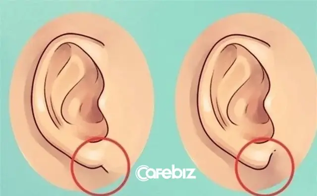 Giải Mã Tướng Đàn Ông Tai Nhỏ: Ý Nghĩa Tính Cách, Vận Mệnh Giàu Nghèo Và Cách Nhìn Chuẩn Nhất