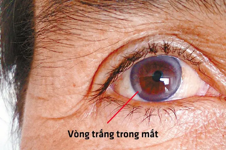 Tướng Đoản Mệnh Là Gì? Tổng Hợp 10+ Nét Tướng Mặt, Dấu Hiệu Nhận Biết Người Yểu Thọ Theo Nhân Tướng Học