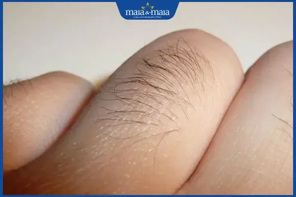 Tướng Lông Ngón Tay: Giải Mã Ý Nghĩa Nhân Tướng, Phong Thủy Và Góc Nhìn Y Khoa Tướng Lông Ngón Tay: Giải Mã Ý Nghĩa Nhân Tướng, Phong Thủy Và Góc Nhìn Y Khoa