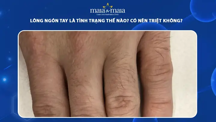 Tướng Lông Ngón Tay: Giải Mã Ý Nghĩa Nhân Tướng, Phong Thủy Và Góc Nhìn Y Khoa Tướng Lông Ngón Tay: Giải Mã Ý Nghĩa Nhân Tướng, Phong Thủy Và Góc Nhìn Y Khoa