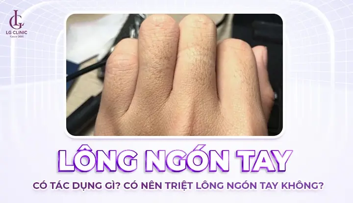 Tướng Lông Ngón Tay: Giải Mã Ý Nghĩa Nhân Tướng, Phong Thủy Và Góc Nhìn Y Khoa Tướng Lông Ngón Tay: Giải Mã Ý Nghĩa Nhân Tướng, Phong Thủy Và Góc Nhìn Y Khoa