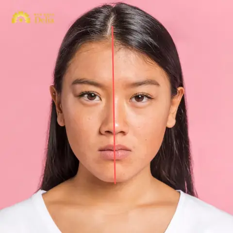 Mặt Lệch: Nguyên Nhân, Ý Nghĩa Nhân Tướng Và Các Cách Khắc Phục Hiệu Quả Nhất Mặt Lệch: Nguyên Nhân, Ý Nghĩa Nhân Tướng Và Các Cách Khắc Phục Hiệu Quả Nhất