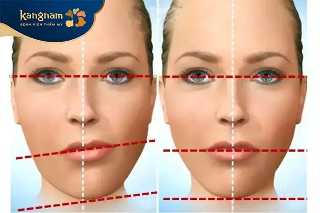 Mặt Lệch: Nguyên Nhân, Ý Nghĩa Nhân Tướng Và Các Cách Khắc Phục Hiệu Quả Nhất Mặt Lệch: Nguyên Nhân, Ý Nghĩa Nhân Tướng Và Các Cách Khắc Phục Hiệu Quả Nhất