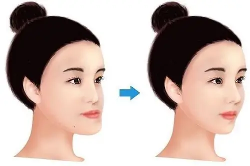 Giải Mã Tướng Mặt Gầy Người Béo: Ý Nghĩa Phong Thủy, Nguyên Nhân Khoa Học & Cách Khắc Phục Cân Đối Giải Mã Tướng Mặt Gầy Người Béo: Ý Nghĩa Phong Thủy, Nguyên Nhân Khoa Học & Cách Khắc Phục Cân Đối