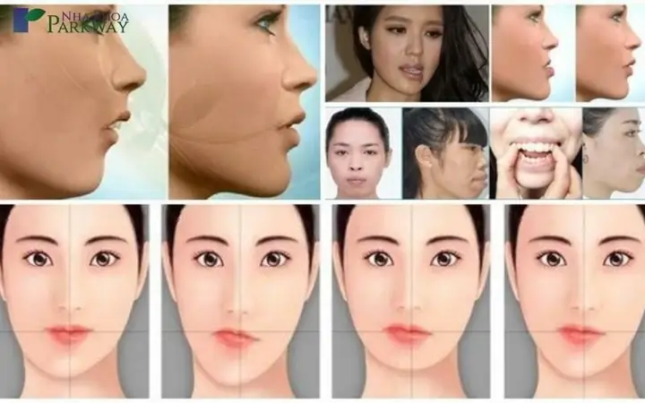 Giải Mã Ý Nghĩa Tướng Mắt Lệch Trong Nhân Tướng Học: Dấu Hiệu Nhận Biết, Vận Mệnh Và Cách Khắc Phục Giải Mã Ý Nghĩa Tướng Mắt Lệch Trong Nhân Tướng Học: Dấu Hiệu Nhận Biết, Vận Mệnh Và Cách Khắc Phục