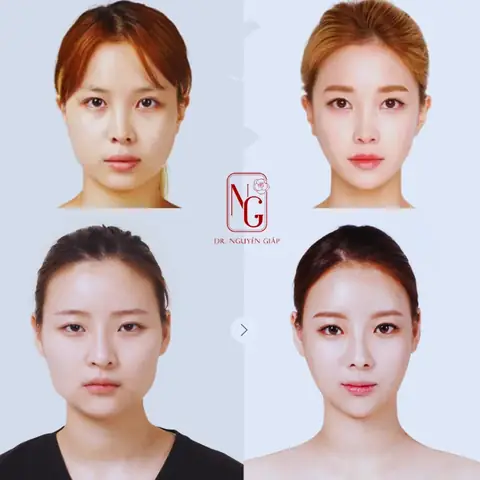 Xem Tướng Mặt Trái Tim: Đặc Điểm Nhận Biết, Tính Cách, Vận Mệnh Nam Nữ & Mẹo Tạo Kiểu Chuẩn Nhất