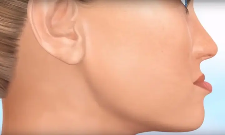 Giải Mã Tướng Miệng Móm: Xấu Hay Đẹp, Tính Cách & Vận Mệnh Nam Nữ Ra Sao? Giải Mã Tướng Miệng Móm: Xấu Hay Đẹp, Tính Cách & Vận Mệnh Nam Nữ Ra Sao?