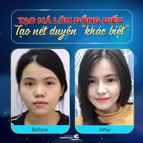 Giải Nghĩa Tướng Miệng Xung Quanh Có Hạt Gạo Là Gì Trong Nhân Tướng Học Và Ý Nghĩa Phong Thủy