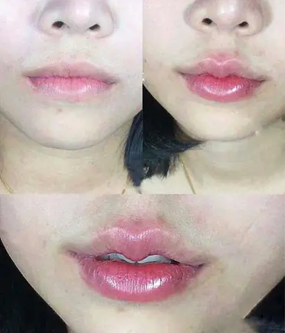 Môi Sừng Trâu (môi Trái Ấu) Là Gì? Ý Nghĩa Tướng Số Đẹp/xấu Cho Nam - Nữ Chi Tiết Môi Sừng Trâu (môi Trái Ấu) Là Gì? Ý Nghĩa Tướng Số Đẹp/xấu Cho Nam - Nữ Chi Tiết
