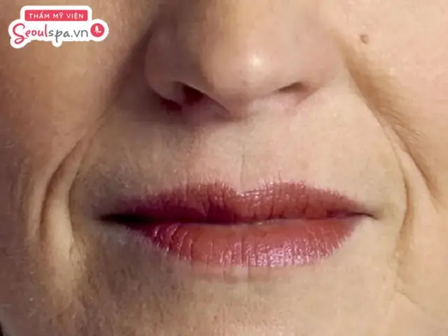 Tướng Môi Thổi Lửa (miệng Xuy Hỏa) Là Gì? Tên Gọi Hán Việt Và Đặc Điểm Nhận Diện Chi Tiết