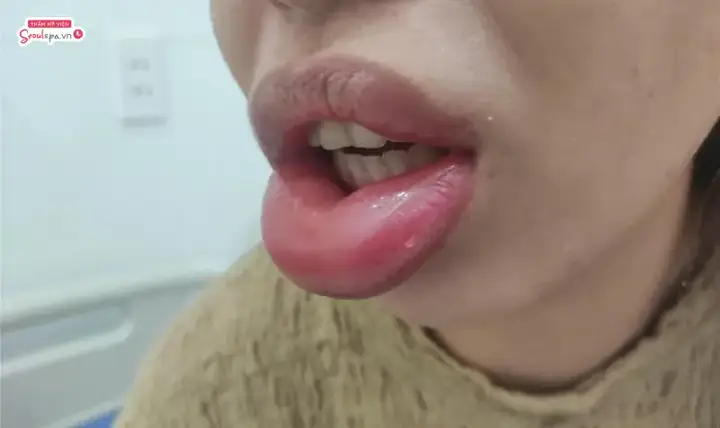 Tìm Hiểu Tướng Môi Trề Răng Khê Nh: Ý Nghĩa Vận Mệnh Và Cách Khắc Phục Cho Người Sở Hữu Dáng Môi Này Tìm Hiểu Tướng Môi Trề Răng Khê Nh: Ý Nghĩa Vận Mệnh Và Cách Khắc Phục Cho Người Sở Hữu Dáng Môi Này