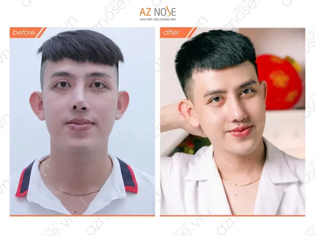 Giải Mã Ý Nghĩa Tướng Mũi Lệch Trong Nhân Tướng: Dấu Hiệu, Tính Cách Và Vận Mệnh Nam/nữ