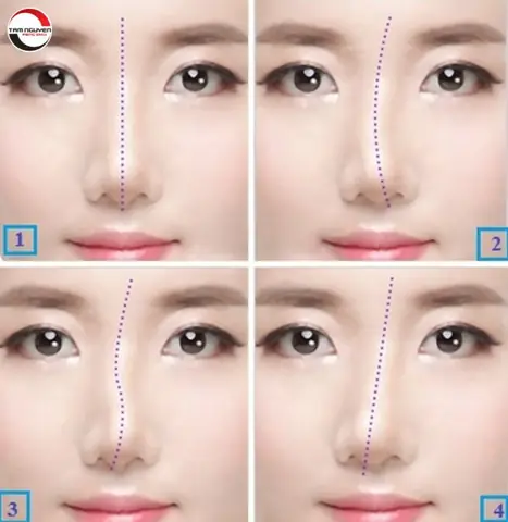 Giải Mã Ý Nghĩa Tướng Mũi Lệch Trong Nhân Tướng: Dấu Hiệu, Tính Cách Và Vận Mệnh Nam/nữ