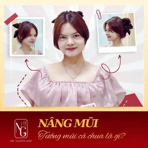 Tướng Mũi Cà Chua Là Gì? Đặc Điểm, Ý Nghĩa Phong Thủy & Cách Khắc Phục Hiệu Quả Tướng Mũi Cà Chua Là Gì? Đặc Điểm, Ý Nghĩa Phong Thủy & Cách Khắc Phục Hiệu Quả