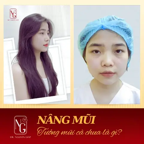 Tướng Mũi Cà Chua Là Gì? Đặc Điểm, Ý Nghĩa Phong Thủy & Cách Khắc Phục Hiệu Quả Tướng Mũi Cà Chua Là Gì? Đặc Điểm, Ý Nghĩa Phong Thủy & Cách Khắc Phục Hiệu Quả