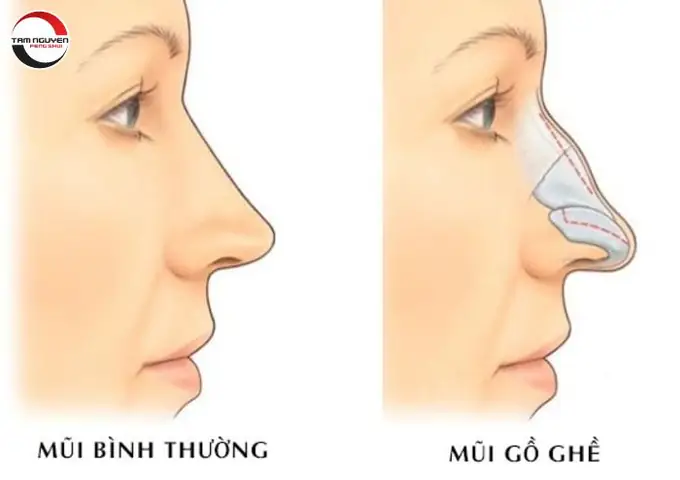 Giải Mã Tướng Mũi Cao Thẳng Ở Nữ Giới Theo Nhân Tướng Học