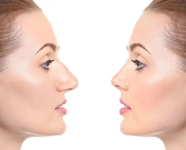 Giải Mã Tướng Mũi Gấp Khúc: Ý Nghĩa Nhân Tướng, Tính Cách, Vận Mệnh & Cách Khắc Phục Giải Mã Tướng Mũi Gấp Khúc: Ý Nghĩa Nhân Tướng, Tính Cách, Vận Mệnh & Cách Khắc Phục