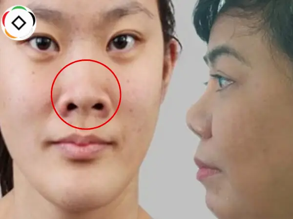 Tổng Hợp Tướng Mũi Nghèo Hèn: 17+ Đặc Điểm Nhận Diện, Phân Biệt Nam/nữ & So Sánh Tướng Mũi Giàu Sang